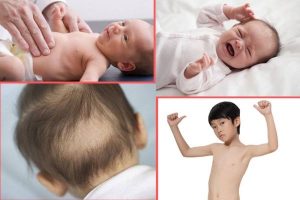 Bệnh còi xương ở trẻ: Nguyên nhân và dấu hiệu nhận biết