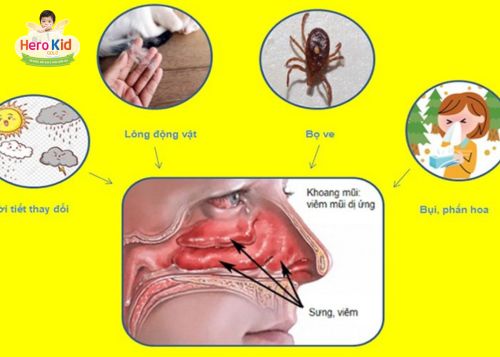 Cách chăm sóc và phòng ngừa tình trạng trẻ viêm mũi dị ứng